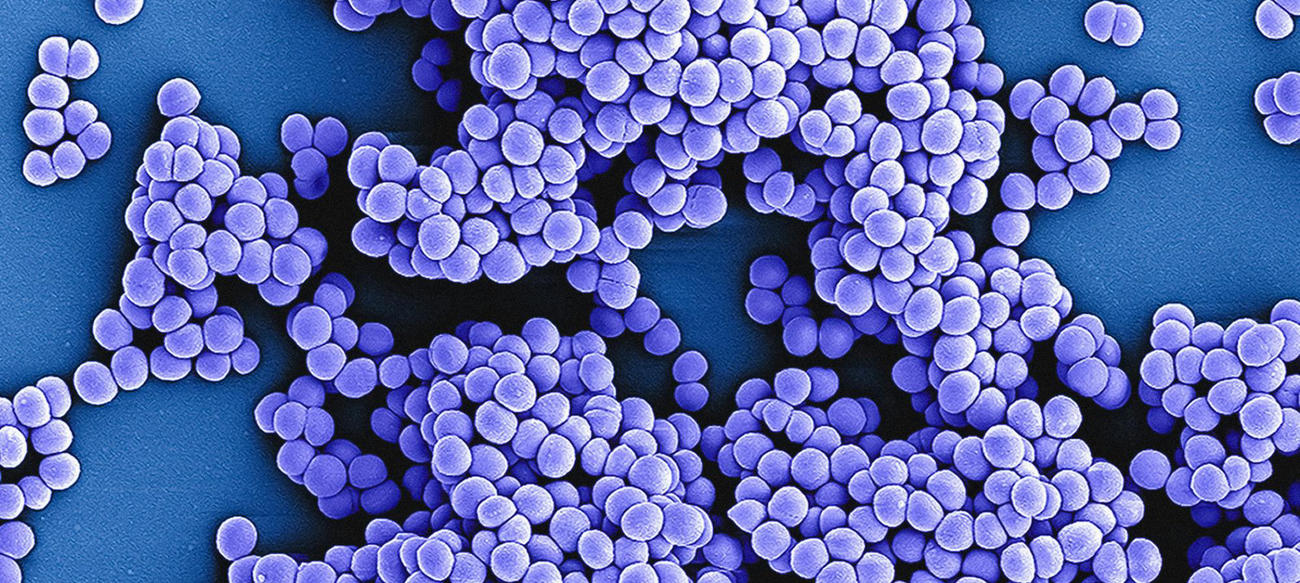 Many hospital infections are caused by methicillin-resistant Staphylococcus aureus strains - known as MRSA for short