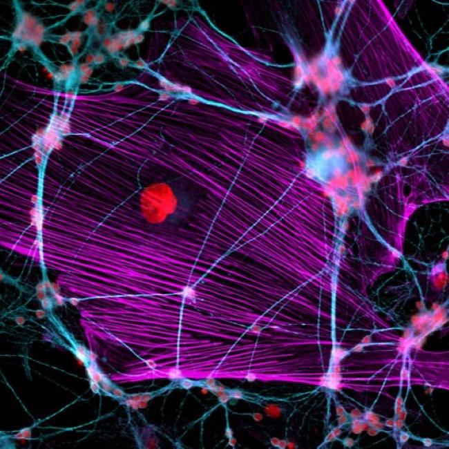 Neuronale Zellkultur, Bild: Dr. Jan Schmoranzer