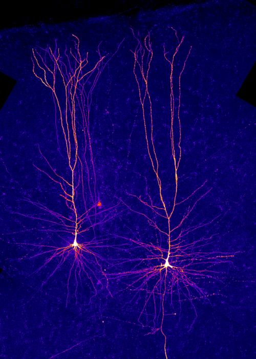 Neuronen in der menschlichen Großhirnrinde © Imre Vida